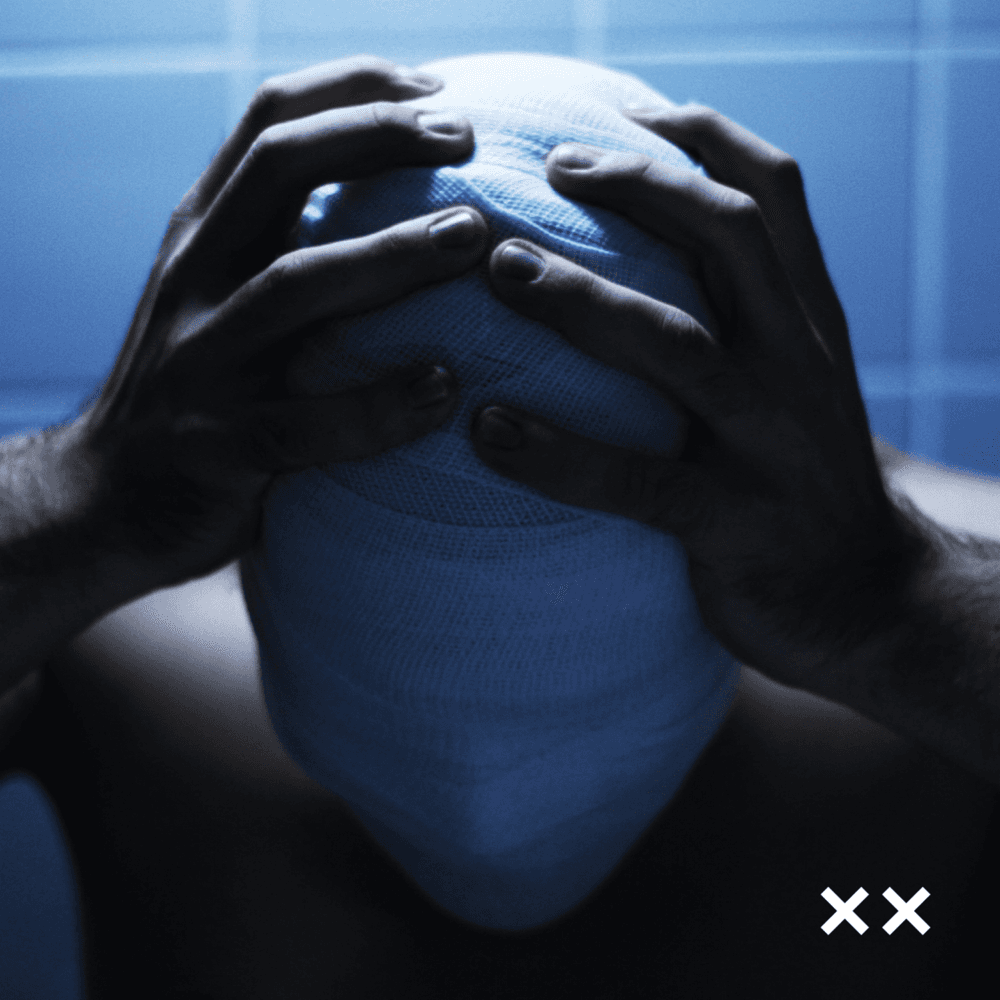 Cover von X X